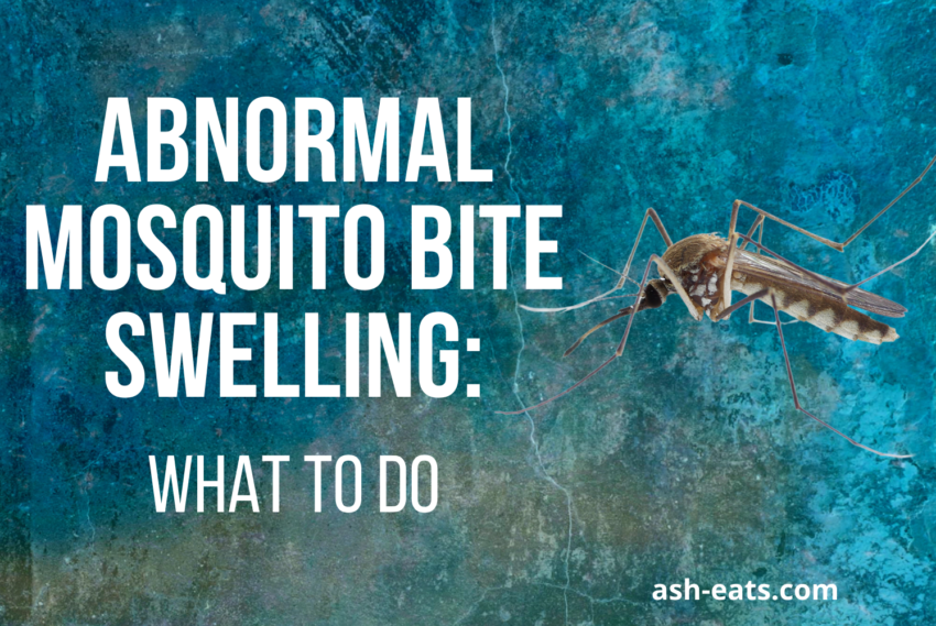 Abnormal Mosquito Bite Swelling: What To Do